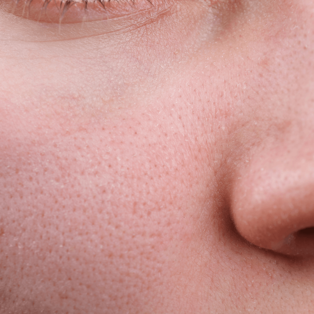 Sensitive Skin
